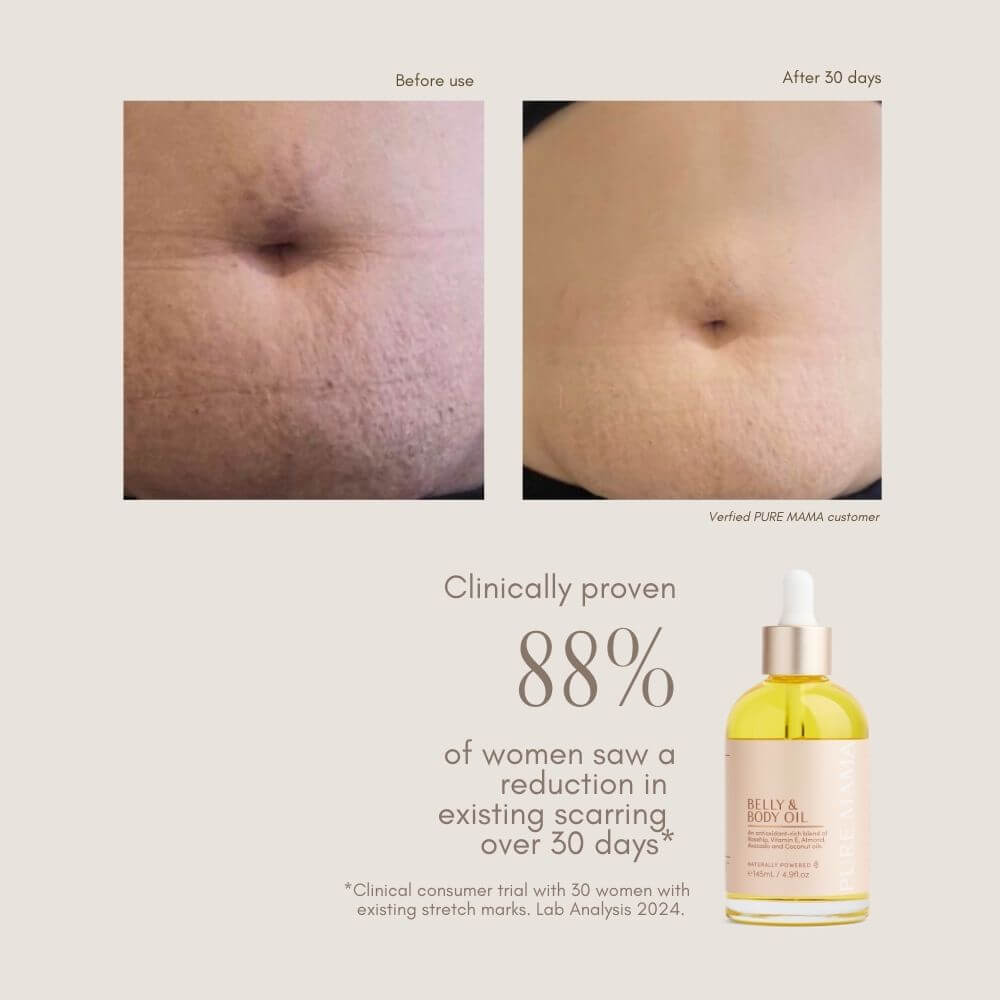 Pure Mama Belly Oil + Body Oil