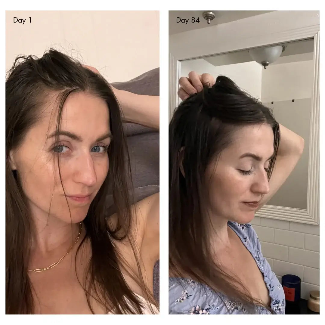 Holi (Growth) 84 Leave-in Hair Growth Scalp Spray