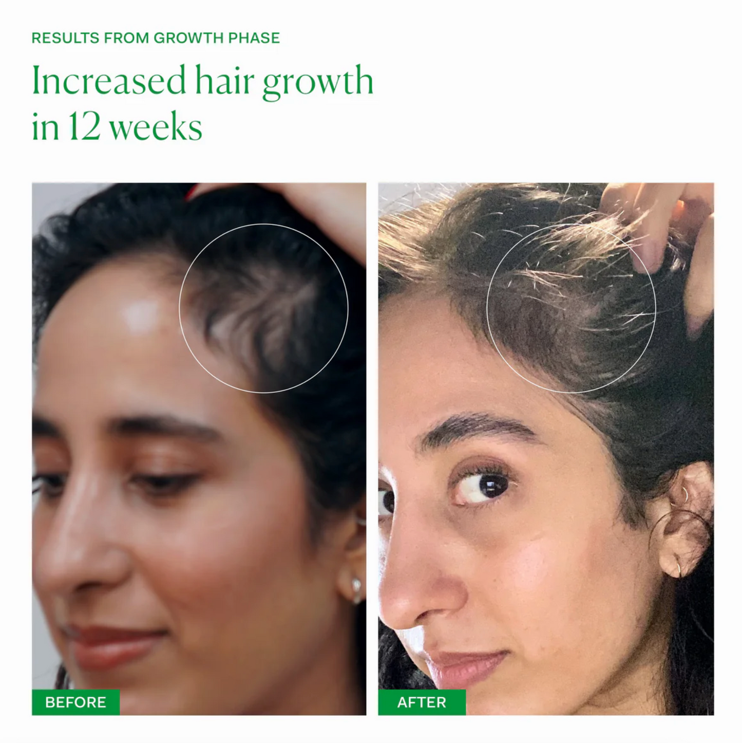 Hair Growth Bundle: Growth Phase + Supa Thick