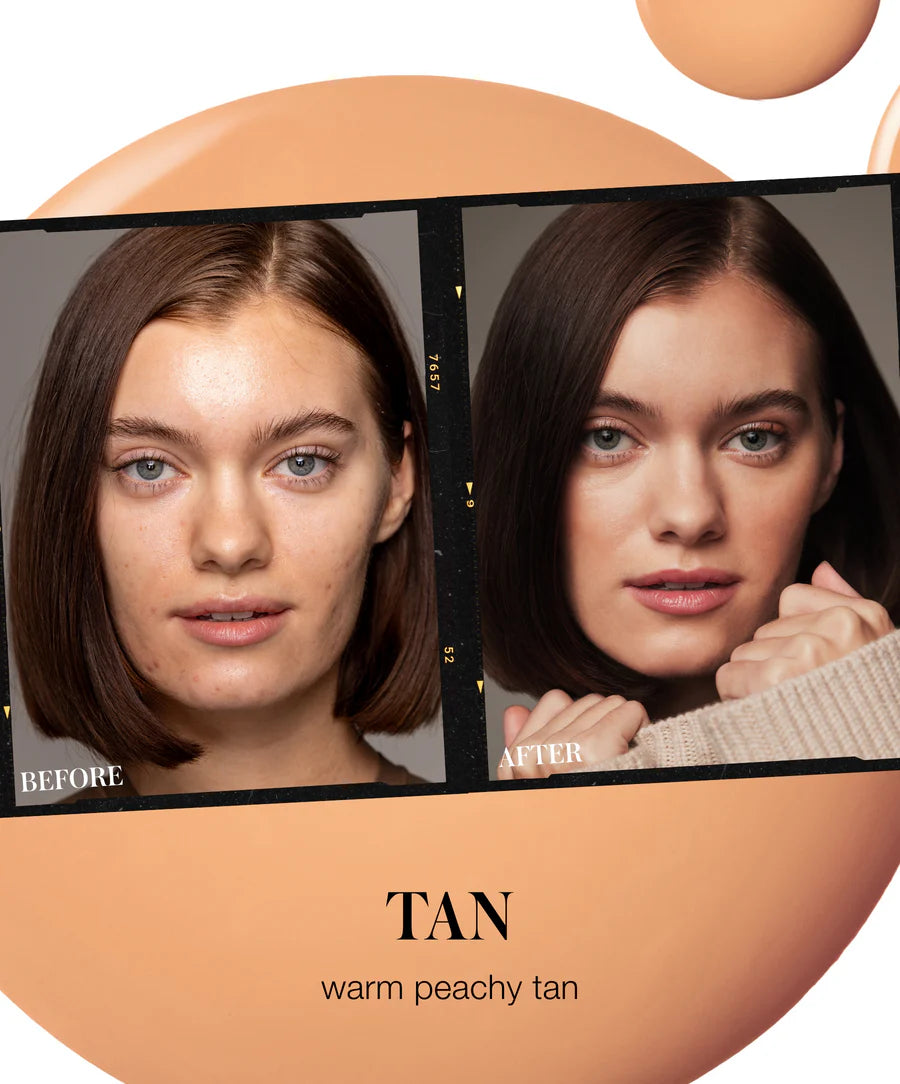 TAN