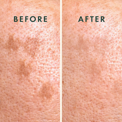 Rael Microcrystal Vitamin C Dark Spot Cover