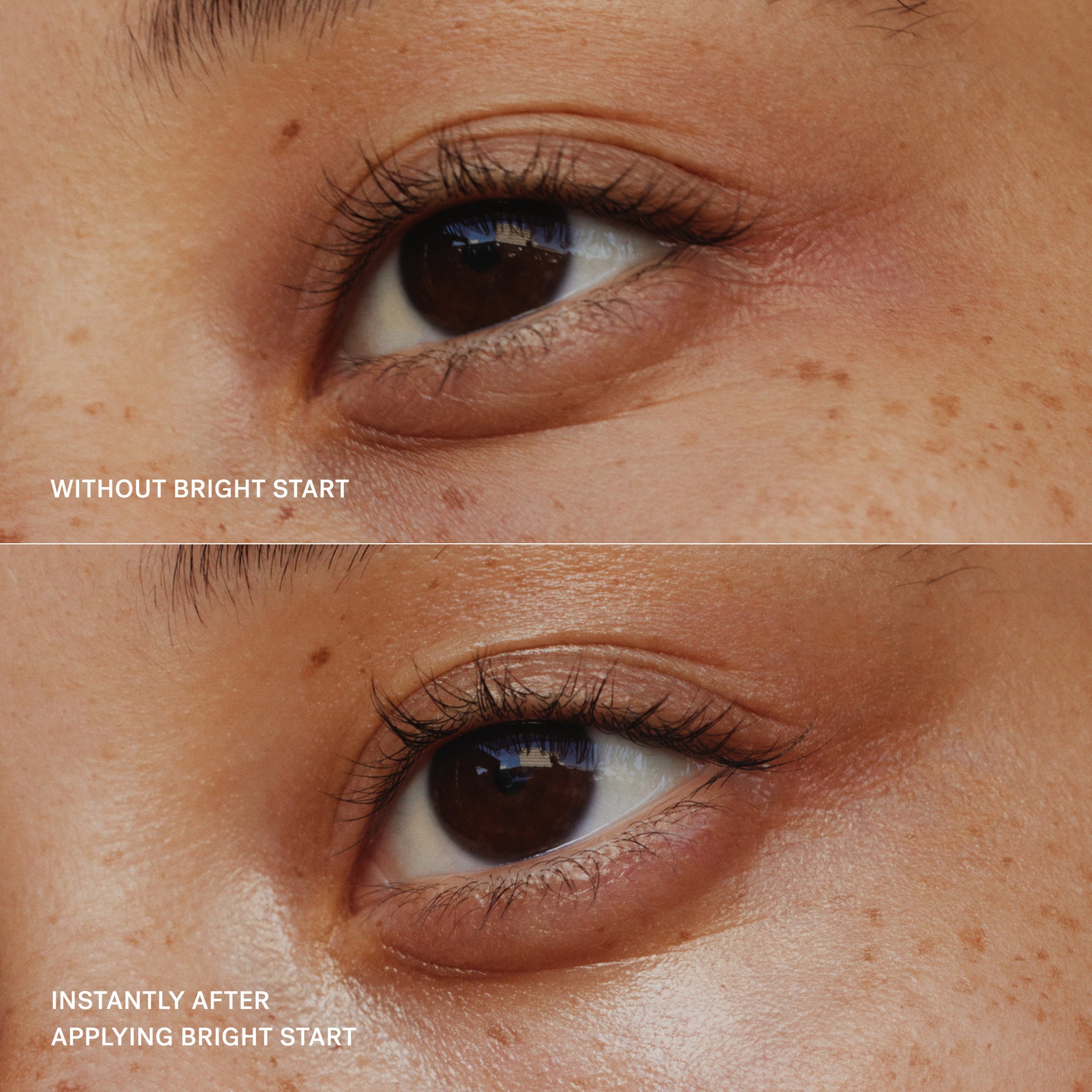 Bright Start B&A 1