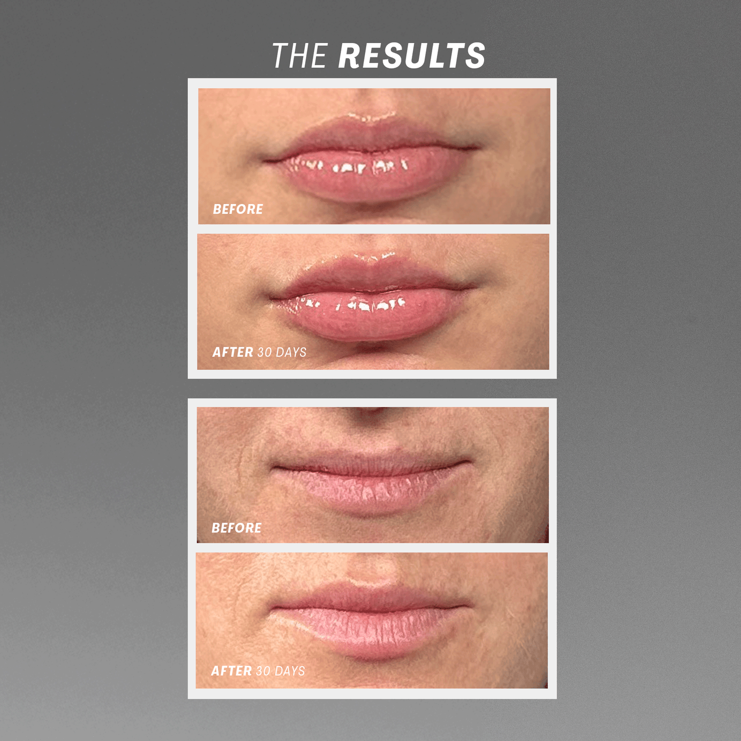 Lip Oasis™️ Glossy Treatment