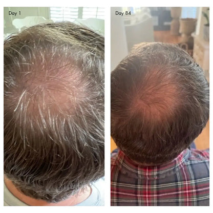 Holi (Growth) 84 Leave-in Hair Growth Scalp Spray