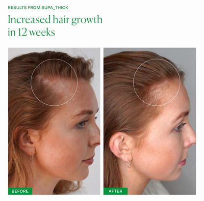 Hair Growth Bundle: Growth Phase + Supa Thick
