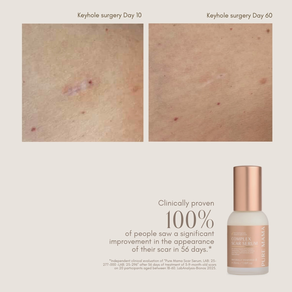 Complex Scar Serum