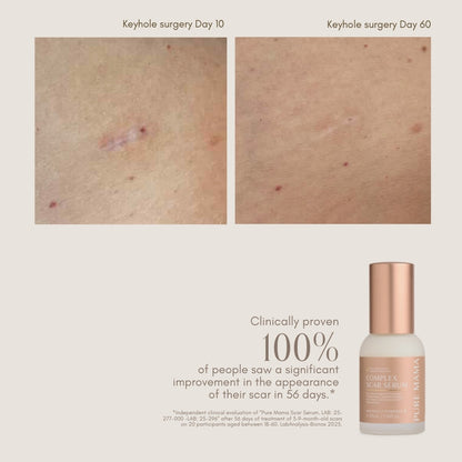 Complex Scar Serum