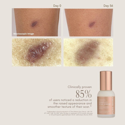 Complex Scar Serum