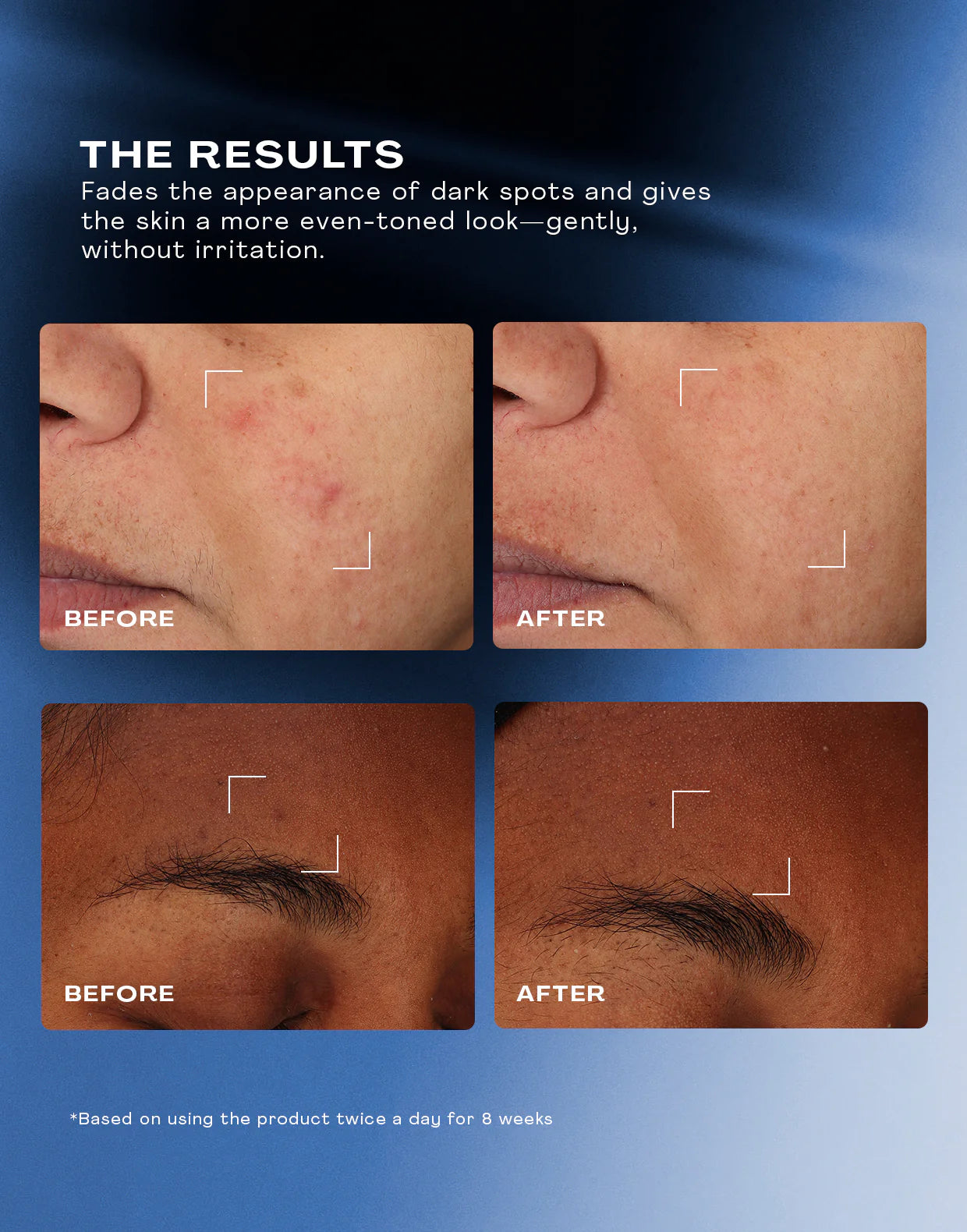 Total Clarity Dark Spot Treatment